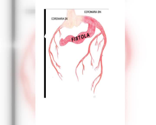 Intervento al cuore "ad alto rischio", salvata neonata